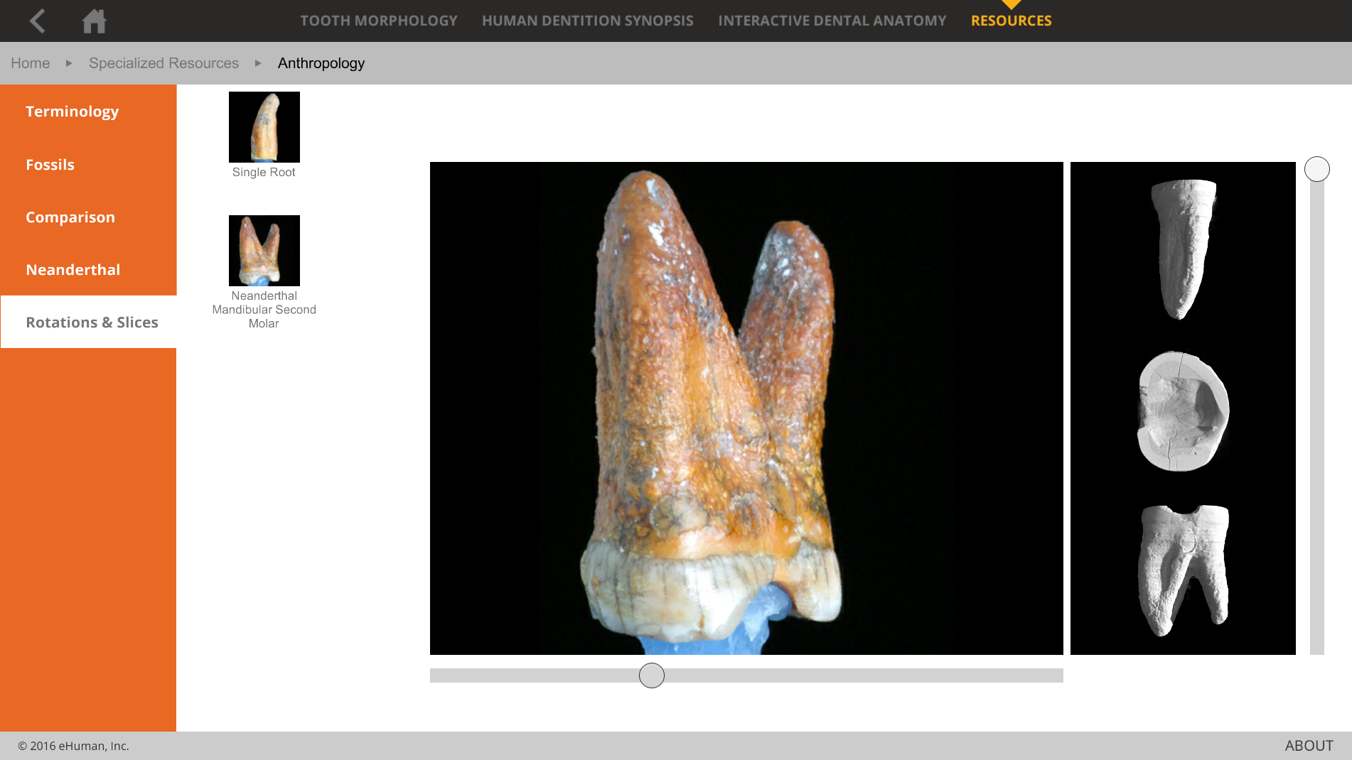 3d tooth atlas 8 university of kentucky clinicalkey