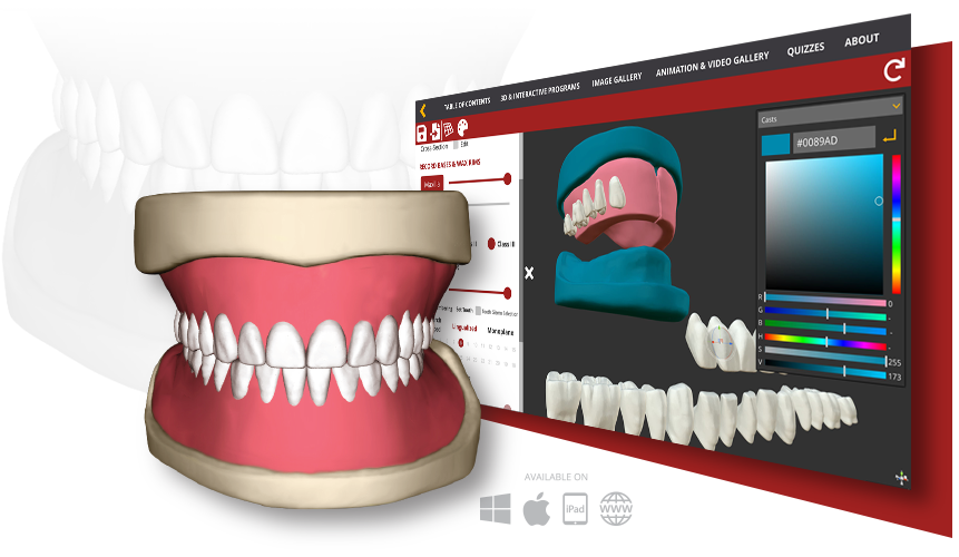 Announcing Complete Dentures - A 3D Evidence-Based Visual Program